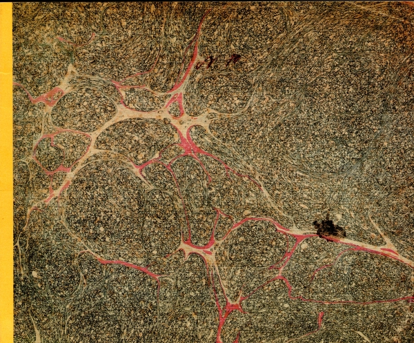 誕生日の贈り物