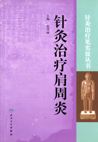 針灸治療肩周炎