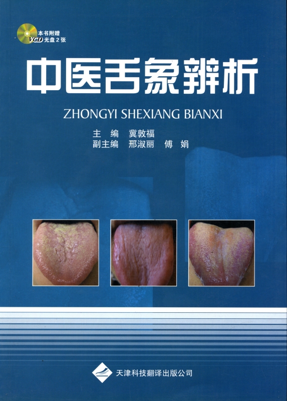 中医舌象辨析_写真