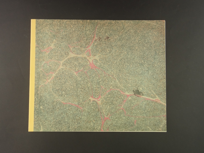 誕生日の贈り物1